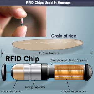 where does it mention the rfid chip in obama care|Affordable Care Act .